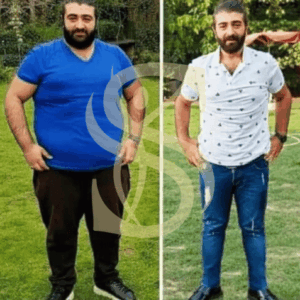 من تجارب عملاء دكتور سليمينج تخسيس